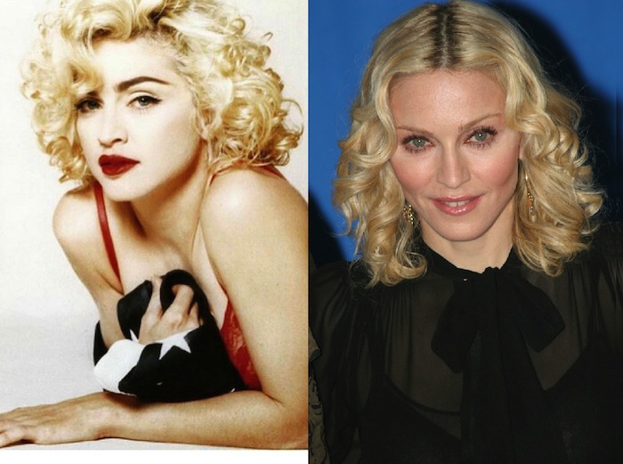 Madonna teria feito bichectomia?