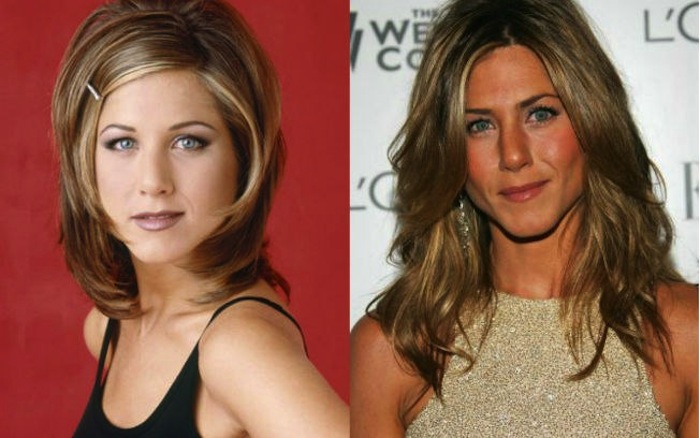 Jennifer Aniston está na lista da possíveis adeptas da tal cirurgia